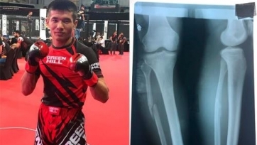 Казахстанец со сломанной ногой завоевал медаль на чемпионате мира по ММА